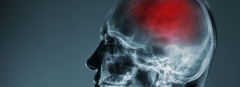 Efectos a largo plazo de las lesiones cerebrales traumáticas